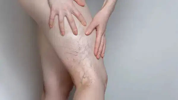 uzmanindan uyari ileri derecedeki varis hayati tehdit edebilir 3amX9Ond.jpg